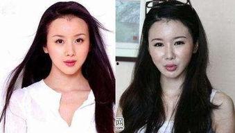 娱乐圈谁承认整容失败,明星整容失败，真实面目曝光引热议